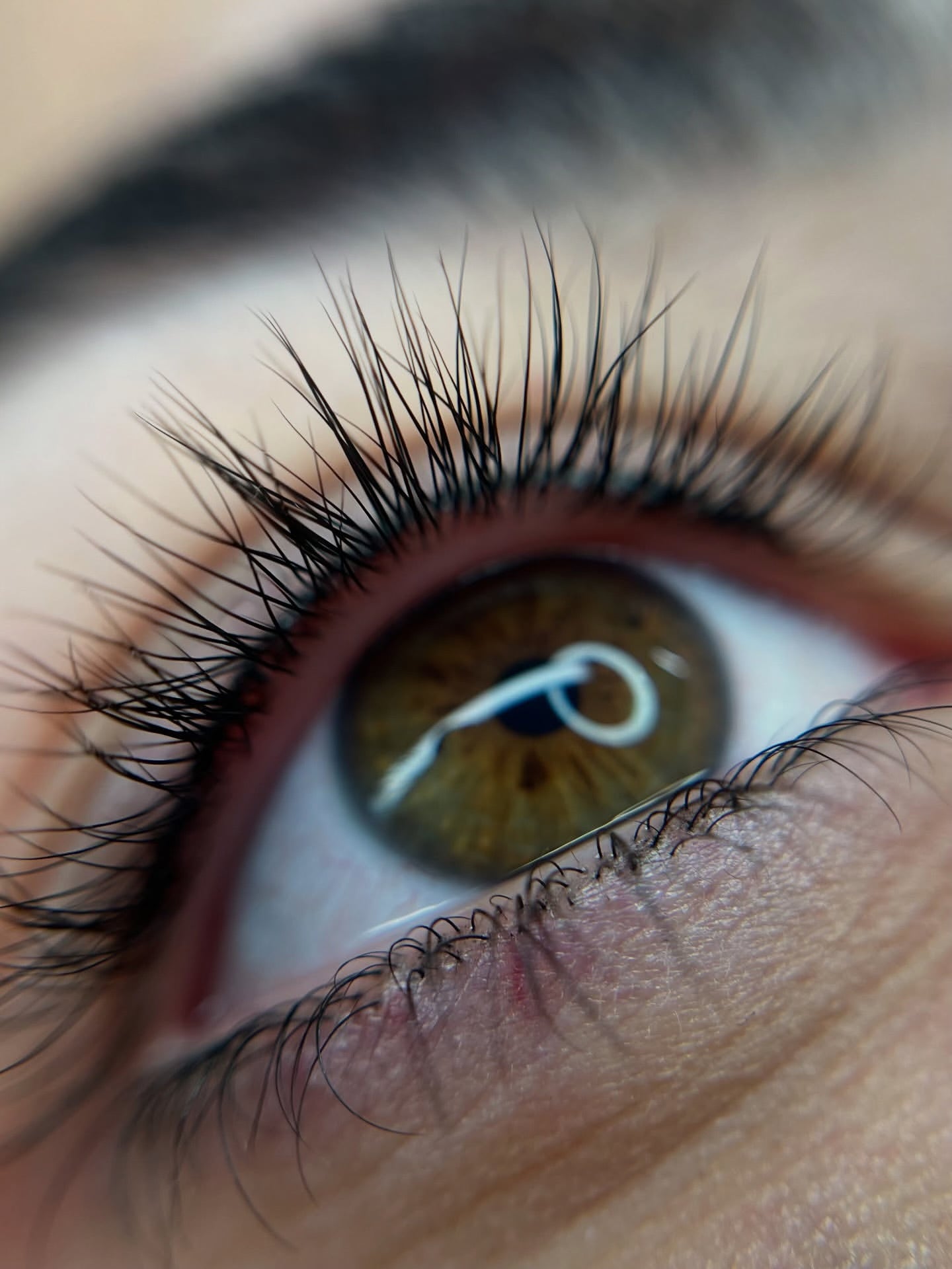 Wimpernkranzverdichtung München