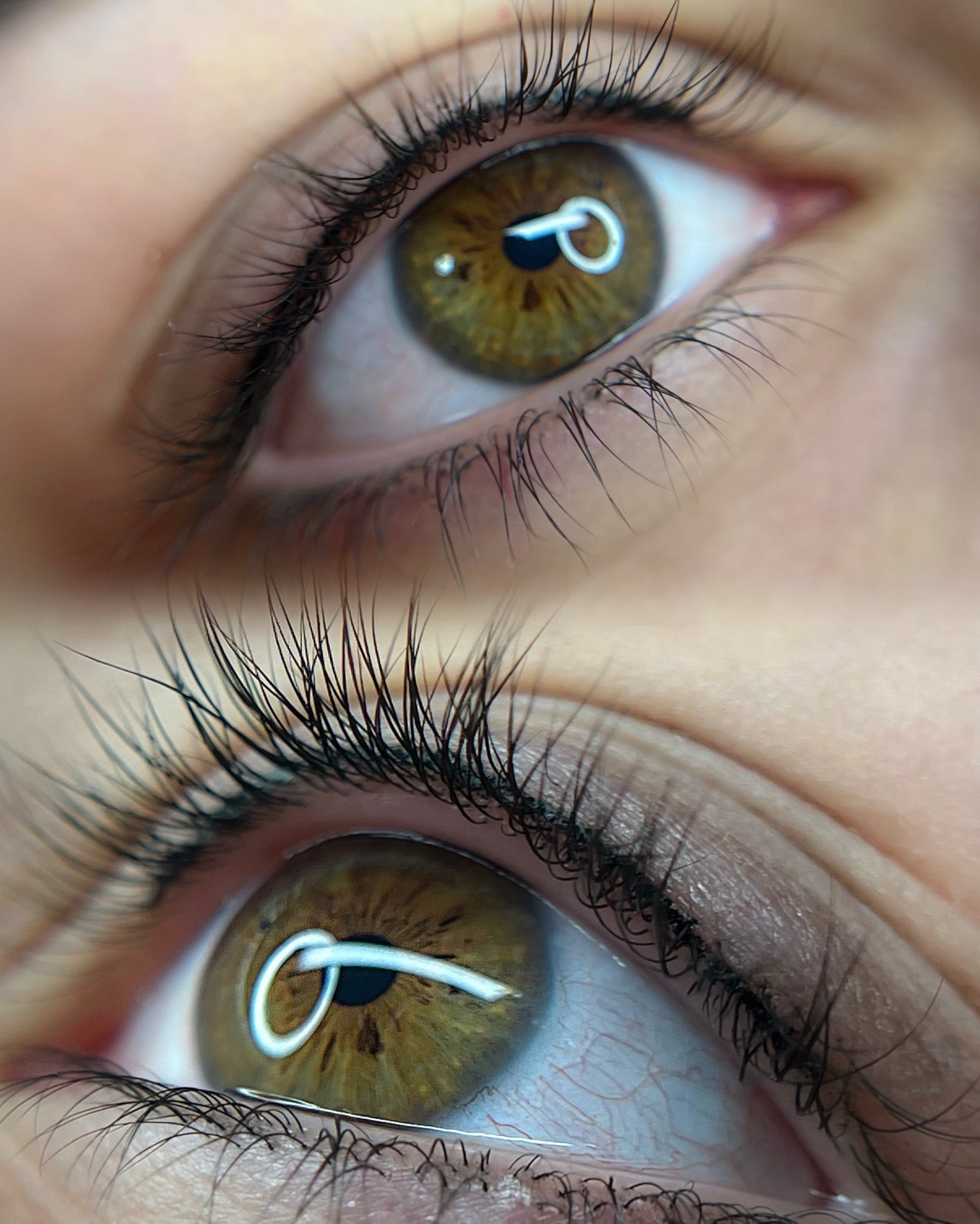 Wimpernkranzverdichtung München