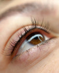 Wimpernkranzverdichtung München