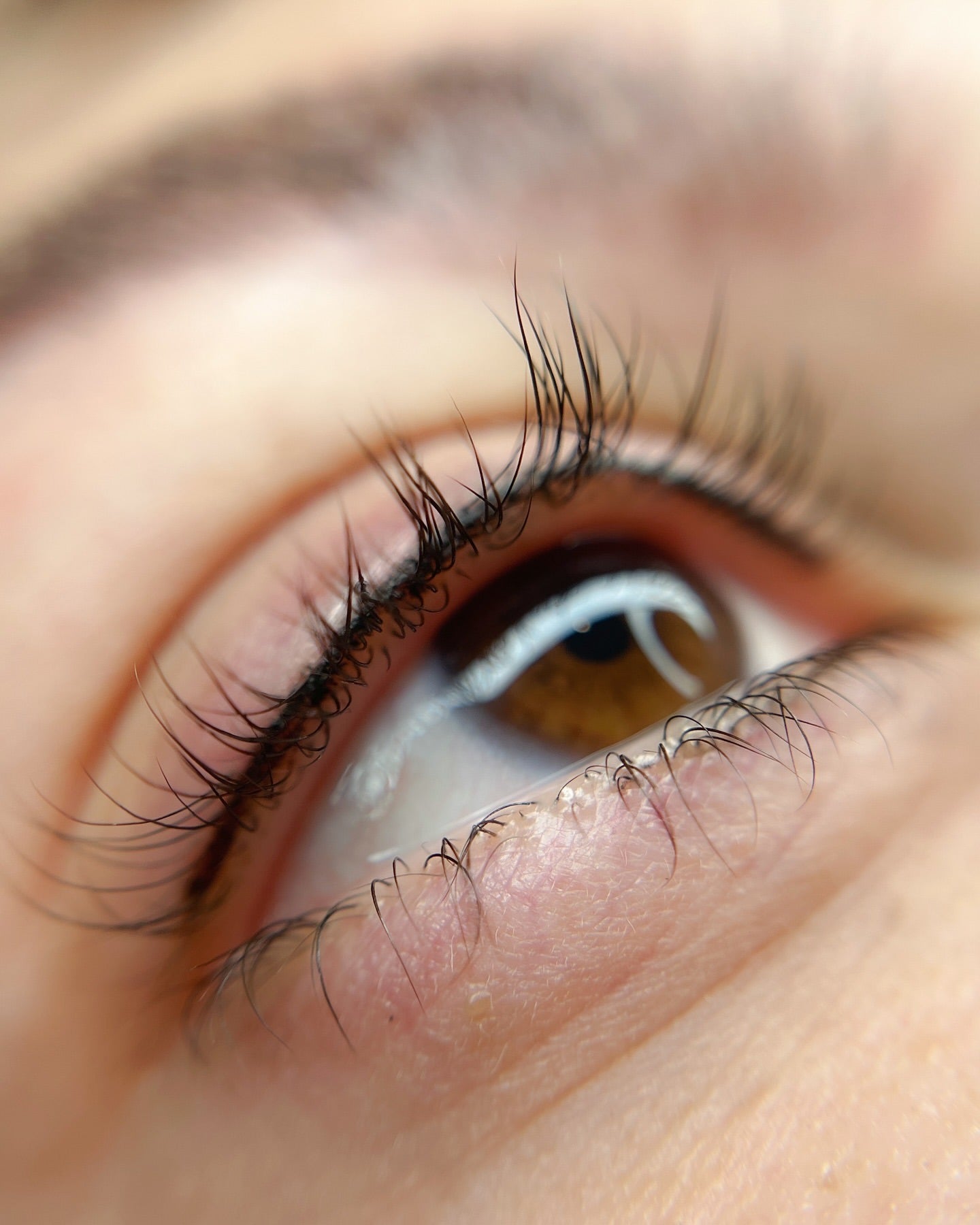 Wimpernkranzverdichtung München