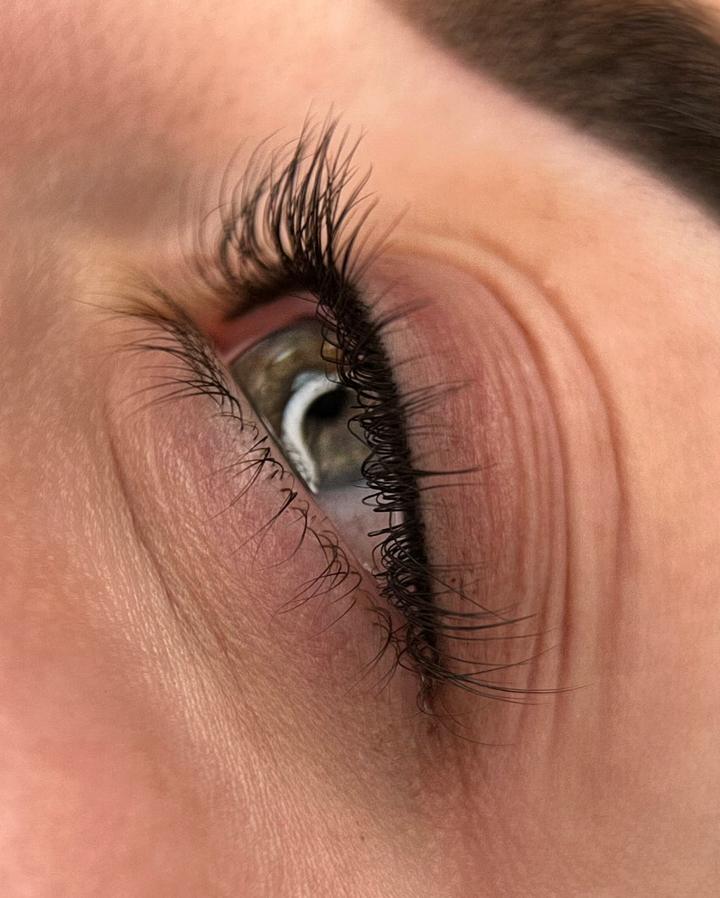 Wimpernkranzverdichtung München