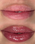 Nachbehandlung Lippen