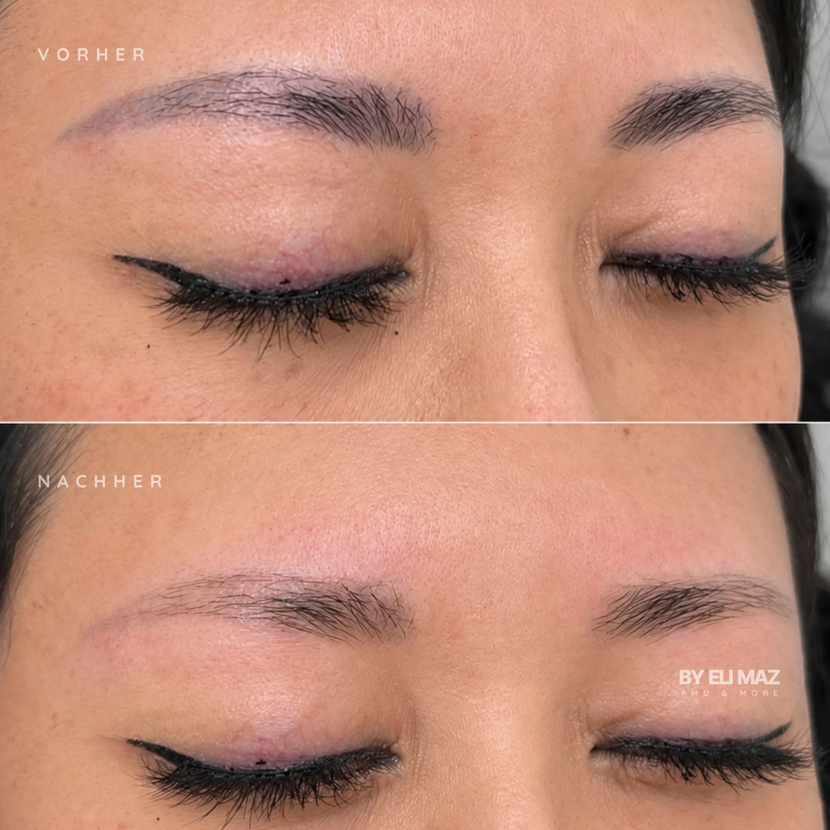 Entfernung Permanent Make-Up Augenbrauen München