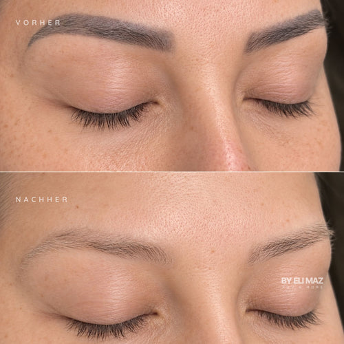 Entfernung Permanent Make-Up Augenbrauen München
