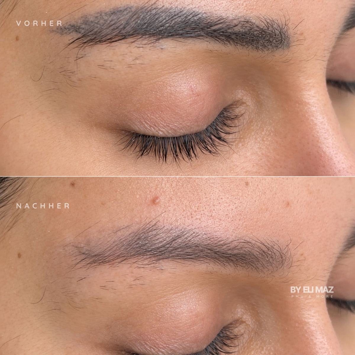 Entfernung Permanent Make-Up Augenbrauen München