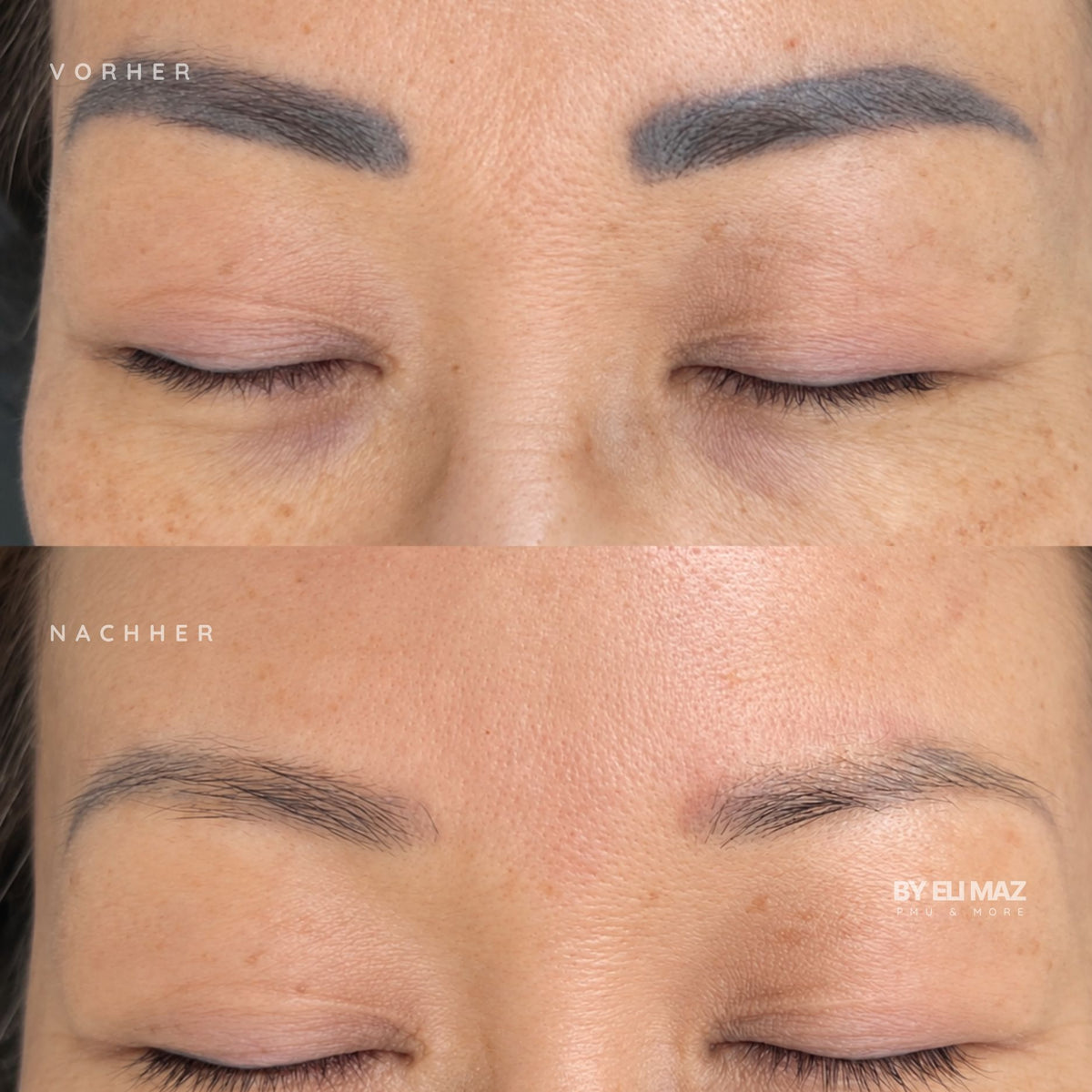 Entfernung Permanent Make-Up Augenbrauen München