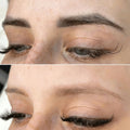 Entfernung Permanent Make-Up Augenbrauen München