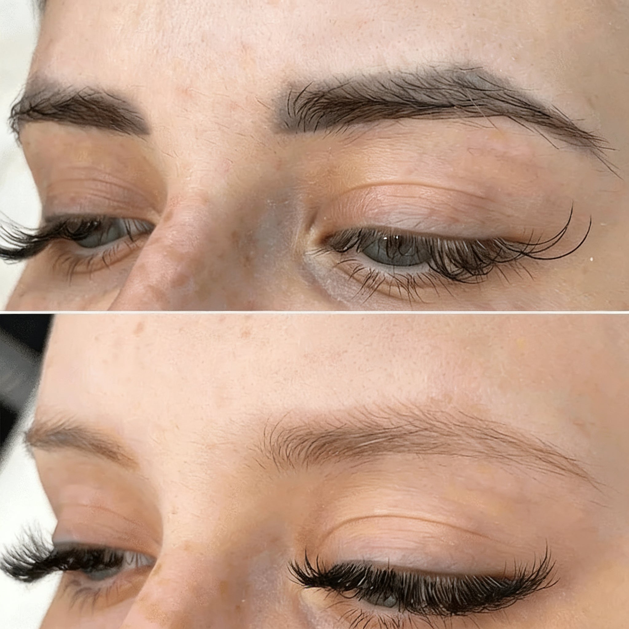Entfernung Permanent Make-Up Augenbrauen München