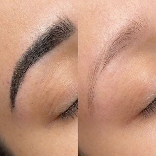 Entfernung Permanent Make-Up Augenbrauen München