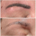 Permanent Make Up Entfernung München Remover Behandlung