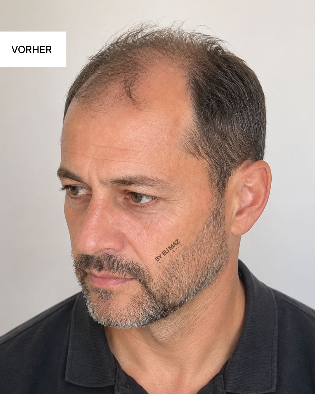 SMP Haarpigmentierung Schulung München