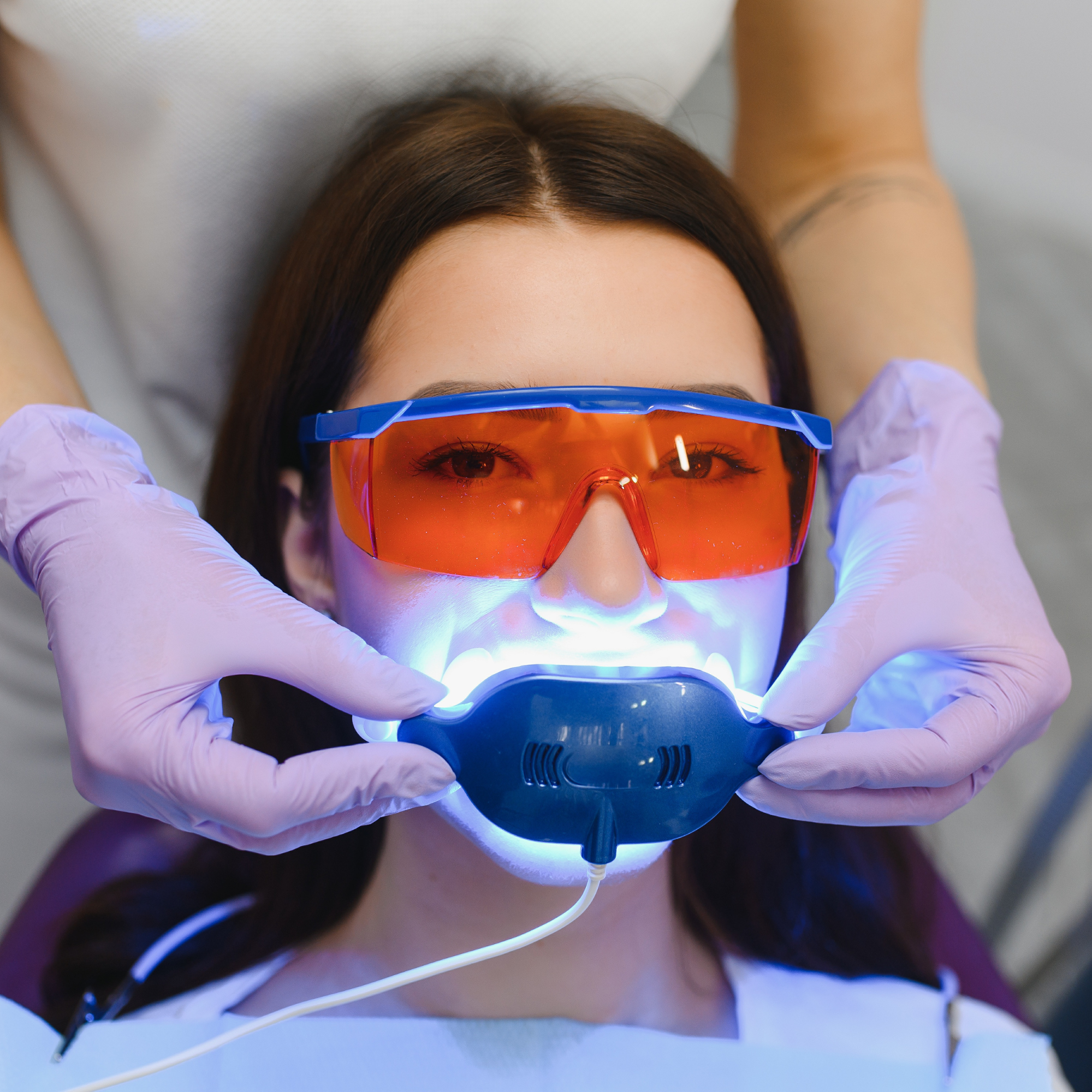 Zahnaufhellung - Zahnbleaching in München