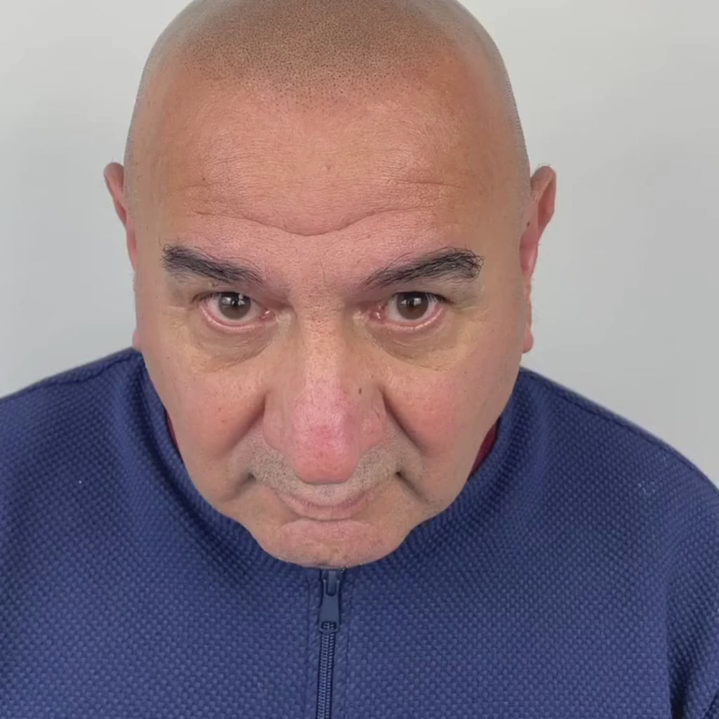 SMP Haarpigmentierung für Glatze München